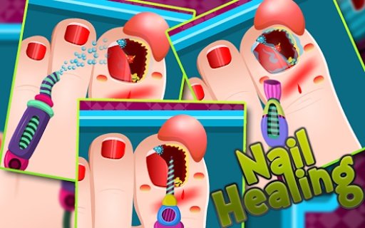 Kids Games - Nail Surgery截图2