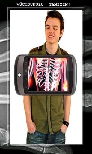 X-Ray Body Scanner HD截图4