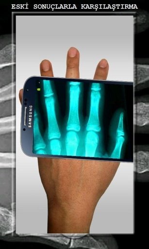 X-Ray Body Scanner HD截图5