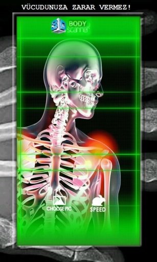 X-Ray Body Scanner HD截图1