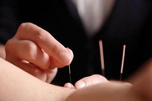 Acupuncture FREE截图2