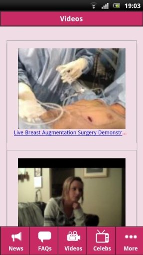 Breast Augmentation 101截图1