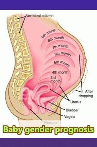 Baby Gender prognosis截图1