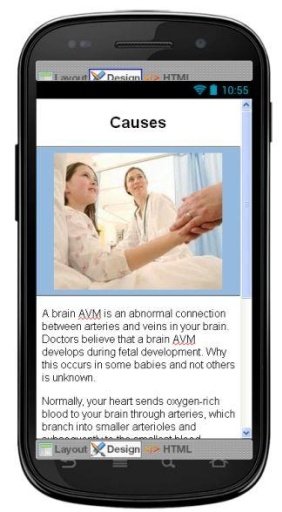 Brain Avm Disease &amp; Symptoms截图5