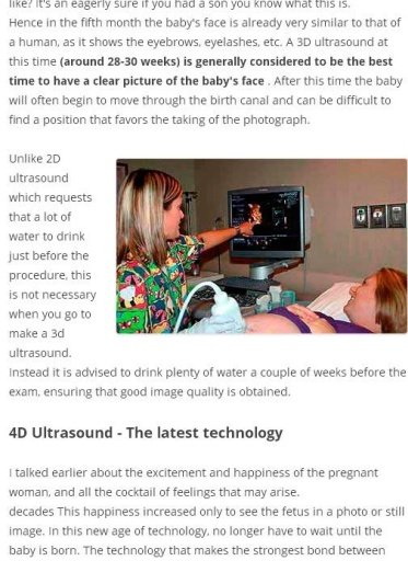 4d Ultrasound, 3d and 2d截图1
