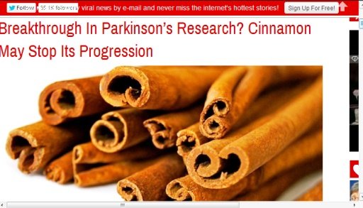 Parkinson's Disease News截图4