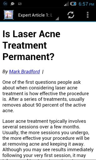 Laser Treatment Acne - Guide截图1