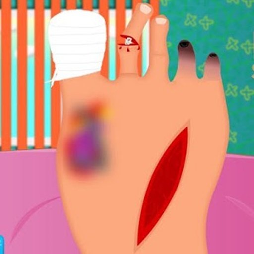 Finger foot surgery截图5