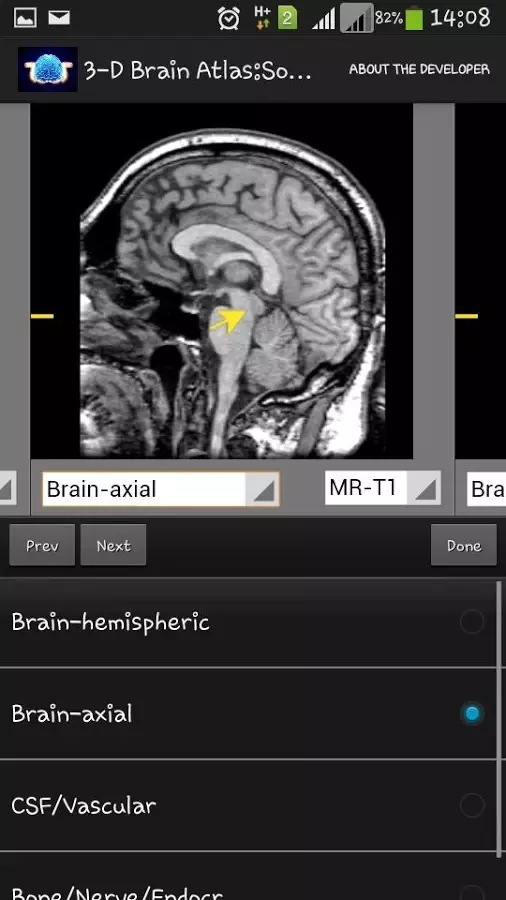 3-D brain Atlas截图3