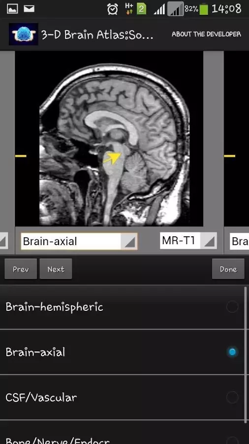 3-D brain Atlas截图2