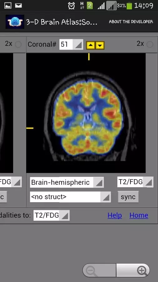 3-D brain Atlas截图4