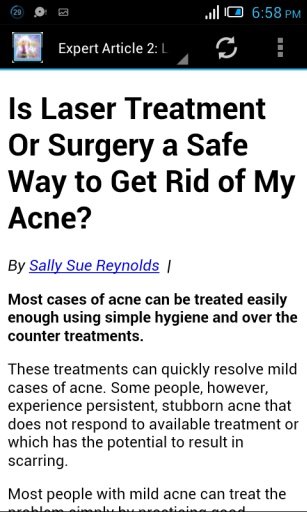 Laser Treatment Acne - Guide截图5