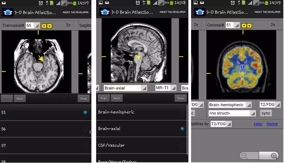 3-D brain Atlas截图1