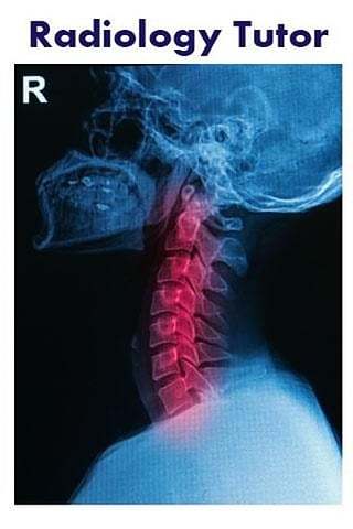 Radiology Tutor截图2