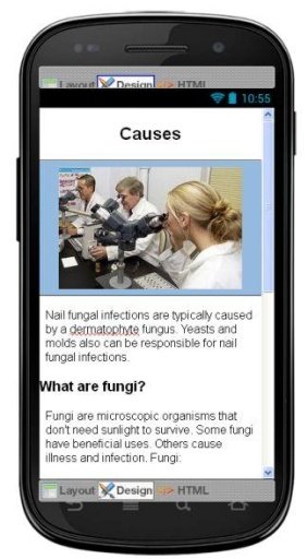 Nail Fungus Disease &amp; Symptoms截图6