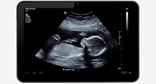 Pregnancy Ultrasound &amp; Scanner截图1