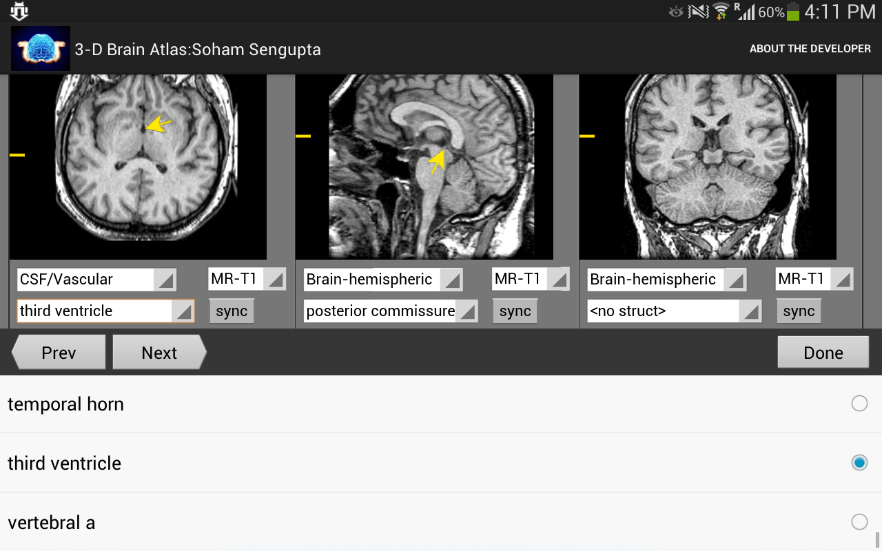 3-D brain Atlas截图5