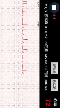 手持心电监护仪截图