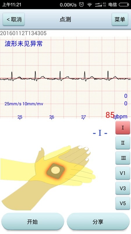 垣星心电截图2