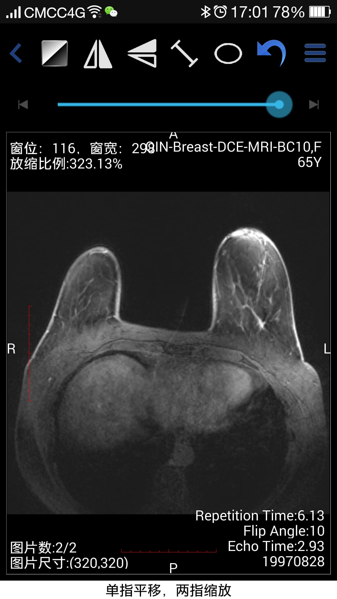 医影云截图3