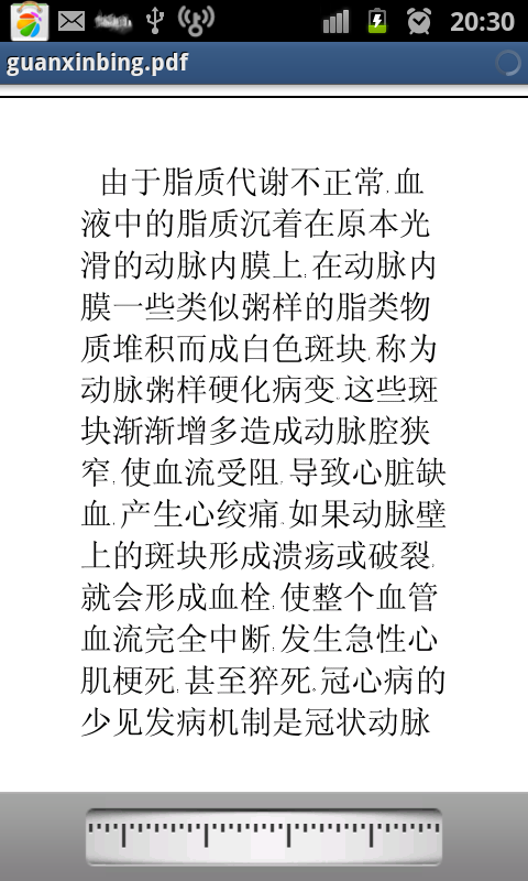 冠心病治疗截图2