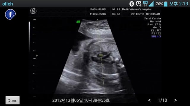 미즈맘산부인과 (거제)截图3