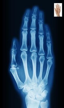 X-Ray Scan截图