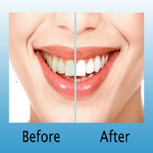 Teeth Whitening DIY截图2