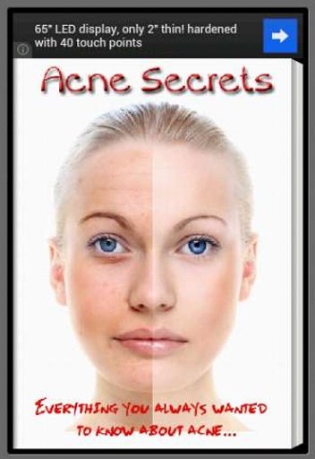 Acne Secrets截图3