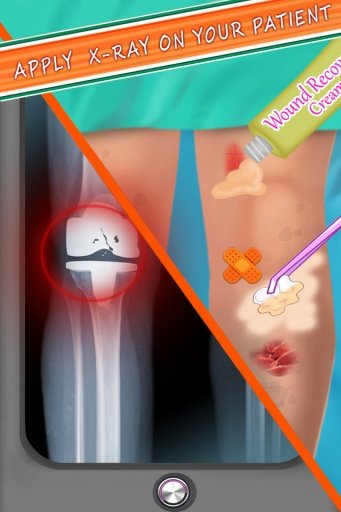 Knee Surgery Doctor截图3