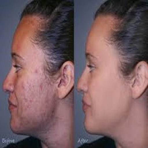 Acne Vitamins截图5