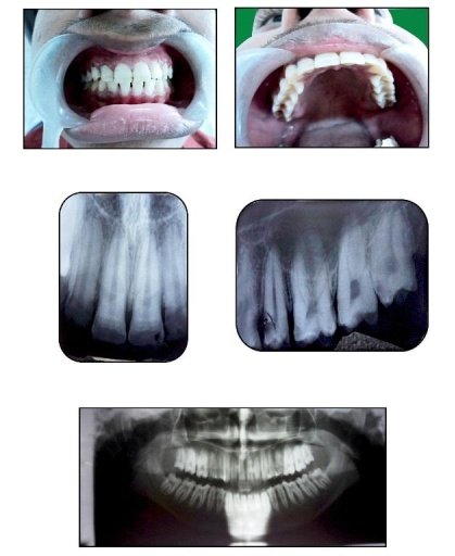 E-JOURNAL OF DENTISTRY截图2