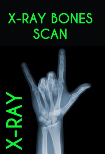 X-RAY BONES SCANNER截图2