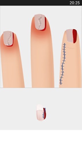 Nail Surgery截图1