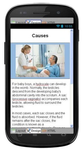 Hydrocele Disease &amp; Symptoms截图2