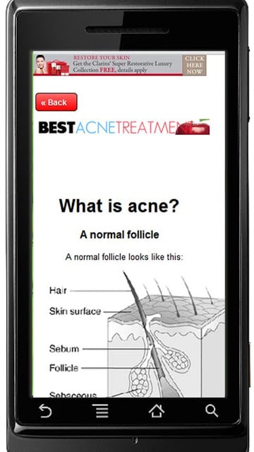 Best Acne Treatment截图3