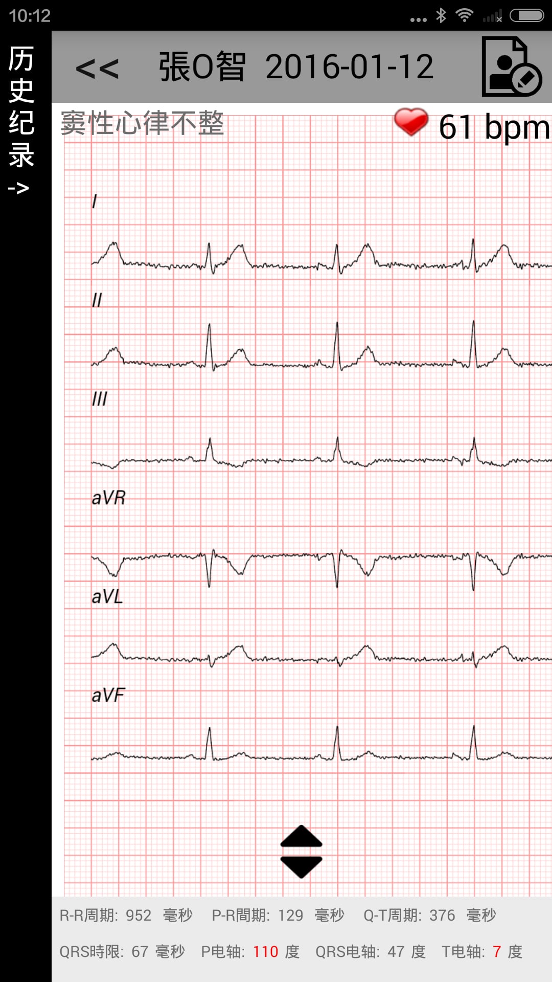 智能ECG截图4