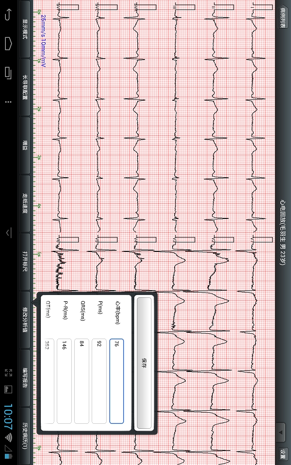 移动心电工作站截图1