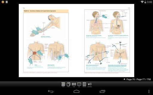 AHA ICD-10 Handbook截图3