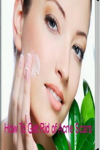 How to Get Rid of Acne Scars截图5