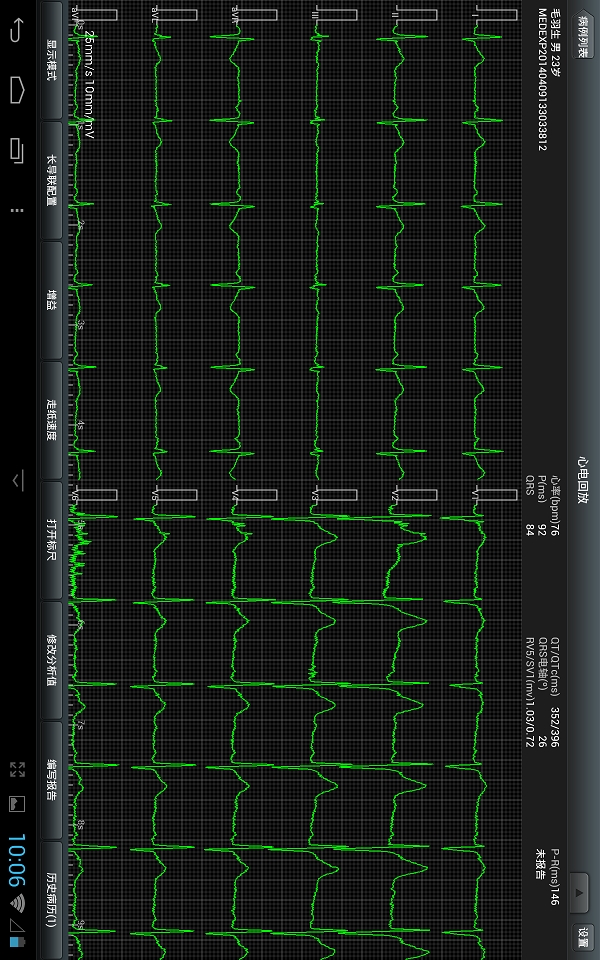 移动心电工作站截图5