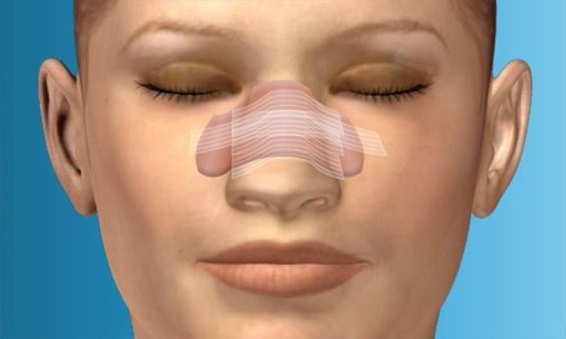 Plastic Surgery Nose Job截图5