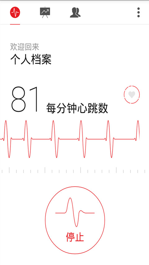 手机心电图截图3
