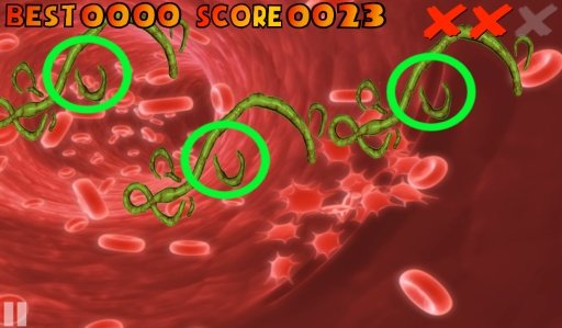 EBOLA NURSE截图4