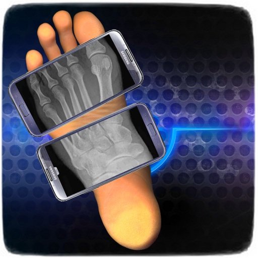 X-Ray Your Body Scanner截图1