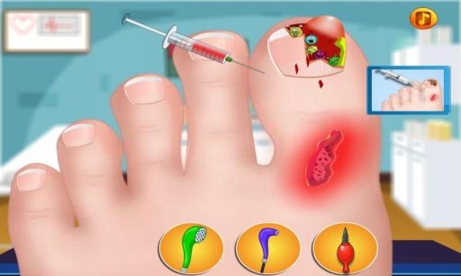 Lady Nail Surgery -Doctor Game截图4