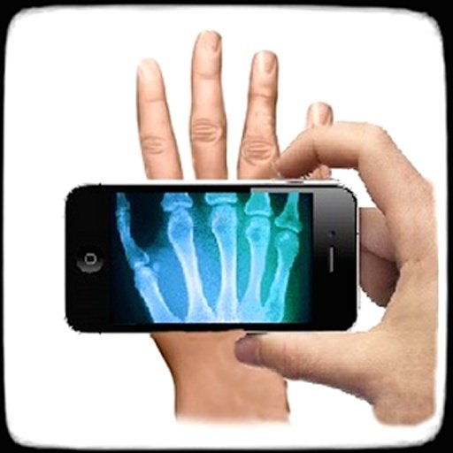 Xray Joke截图2