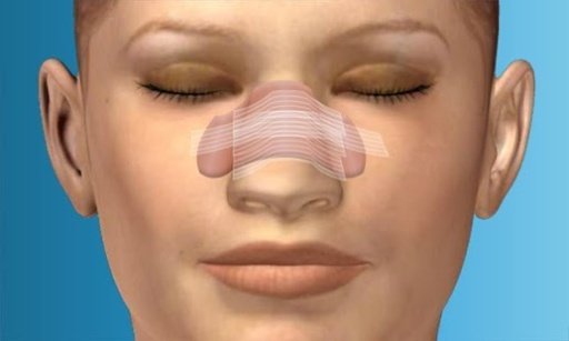 Plastic Surgery Nose Job截图6