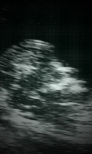 XRay Ultrasound Pregnancy Test截图5