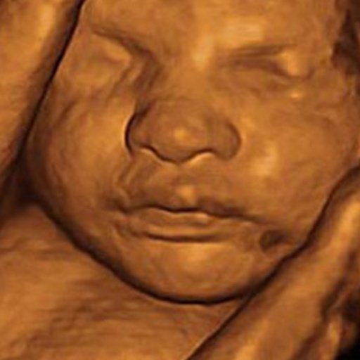 BABY SCANNER 4D ULTRASOUND截图5